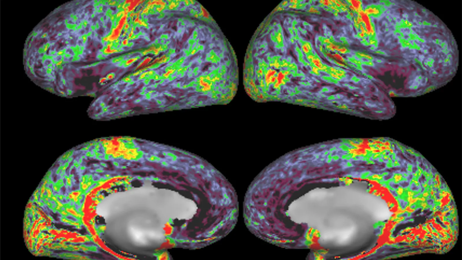 fMRI scan of four brains with areas highlighted in red, green, yellow, and teal
