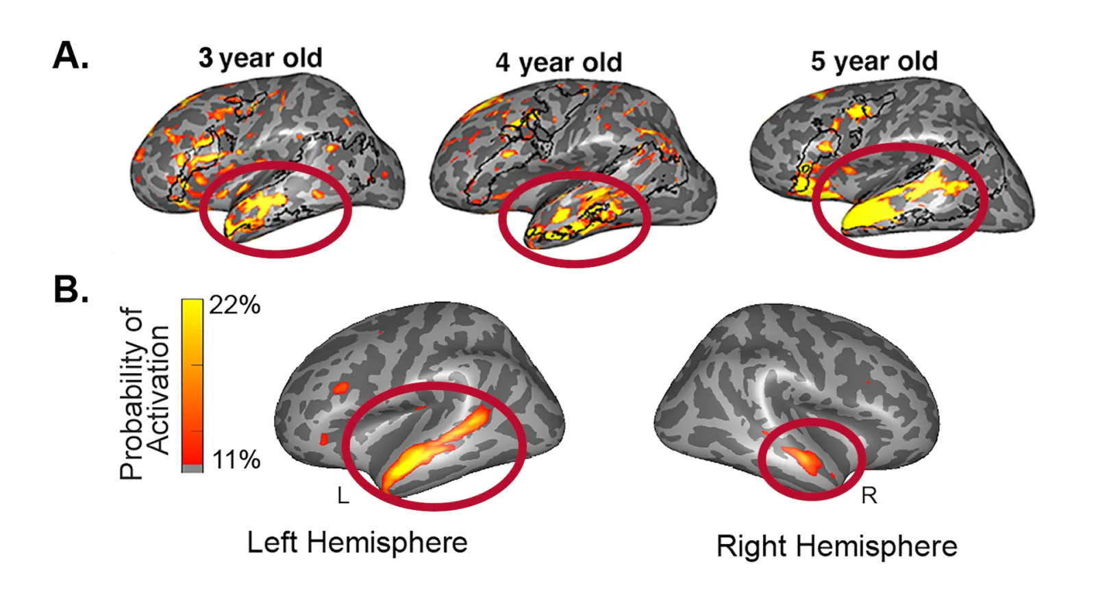 Five gray brain illustrations with portions of the lower right highlighted in yellow and red.