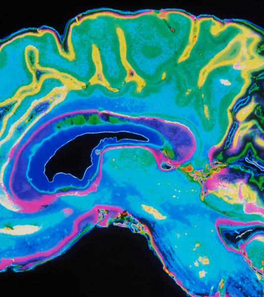 Areas and Training Programs Department of Psychology