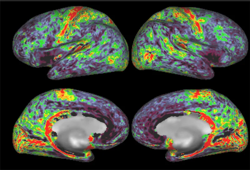 Four views of fMRI brain imaging with highlights in green, yellow, and red.